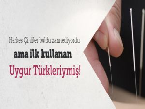 Akupunkturu Çinliler Değil Türkler Bulmuş