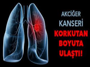 AKCİĞER KANSER VAKALARI ARTIYOR